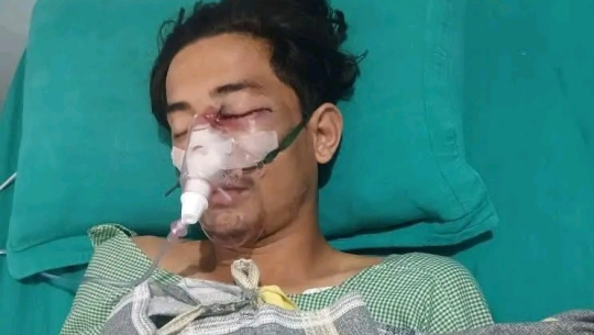घाइते करन पालको धनगढीमा उपचार गरिँदै। तस्बिरः सामाजिक सञ्जाल