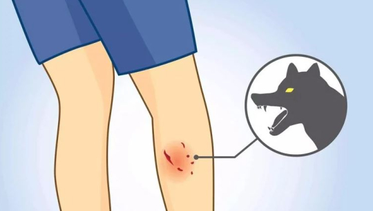 कुकुरको टोकाइबाट एकैदिन १७ जना घाइते