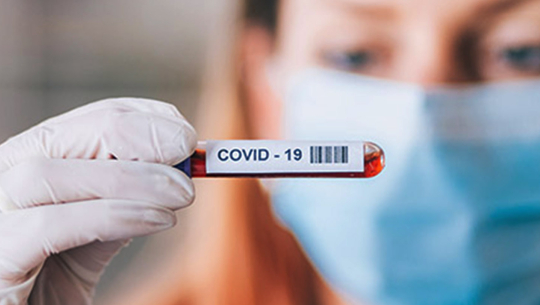 सुदुरपश्चिममा १९ जना कोरोना संक्रमण पुष्टि