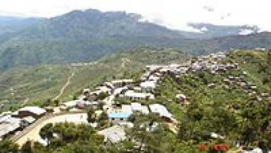 कालीकोट जिल्ला अस्पतालमा दन्त उपचार सेवा सुरु