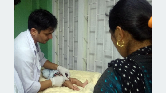बच्चाको टालिएको मलद्वारदेखि फुटेको आन्द्रासम्मको उपचार नेपालमै