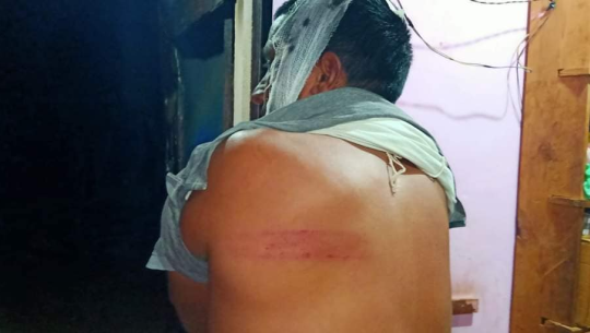 बैतडीमा अस्पताल निर्माणमा विवाद हुँदा कुटाकुट, दुई वडाका ३५ जना घाइते