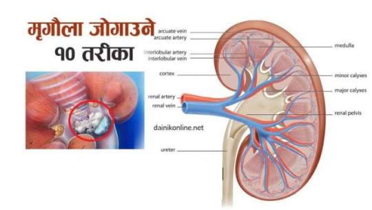 तपाईंका यी दश बानीहरुले मृगौला बिगार्न सक्छ है !