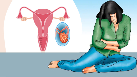 कैलालीमा लगाइँदैछ ५० हजार किशोरीलाई क्यान्सर विरुद्धको खोप