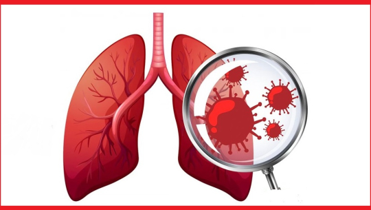 डडेल्धुरामा क्षयरोगका ७१ नयाँ बिरामी