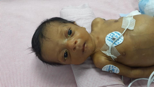 बैतडीका पत्रकार अवस्थीका छोराको कलेजो प्रत्यारोपणमा आर्थिक सहयोगको अपिल