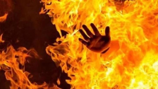 बझाङमा आगोमा परेर एक महिला घाइते