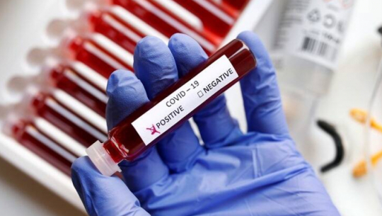 देशभर ७३ जनामा कोरोना संक्रमण पुष्टि