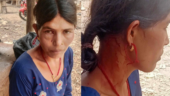 बैतडीमा चितुवाको आक्रमणबाट एक महिला घाइते