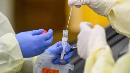 सरकारले घटायो पीसीआर परीक्षण शुल्क