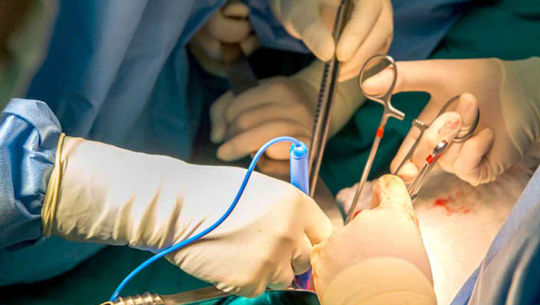 नेपालमा पहिलो पटक मुटुको कृत्रिम भल्व प्रत्यारोपण