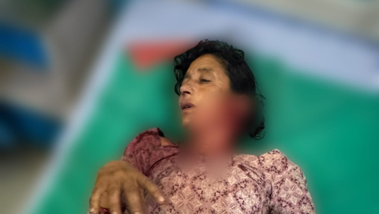 शुक्लाफाँटामा बाघको आक्रमणबाट महिला घाइते, माया मेट्रो अस्पतालमा उपचार हुँदै