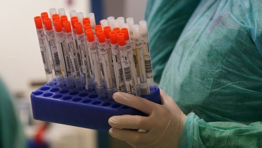 थप १५८ जनामा कोरोना सङ्क्रमण पुष्टि