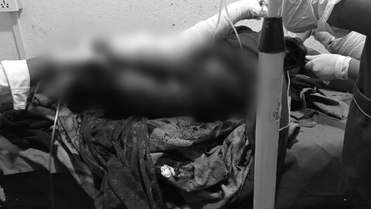 दार्चुलामा एक महिलाले आफैमाथि  मट्टीतेल छर्केपछि... 