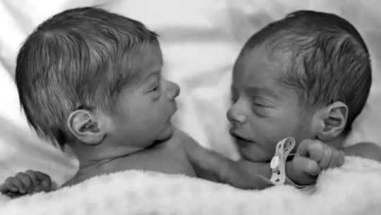 एकैदिन दुई जनासँग सहवास गरेकी युवतीले जन्माइन् जुम्ल्याहा बच्चा, दुवैका बुवा अलग–अलग