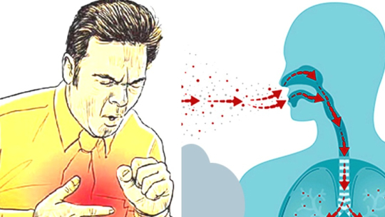 बैतडीमा क्षयरोग पत्ता लगाउन गाउँ गाउँ पुग्दै स्वास्थ्यकर्मी