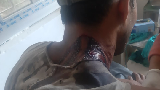बझाङमा आफ्नो जमिनमा माटो फालेको भन्दै हँसिया प्रहार, दुई जना गम्भीर घाइते