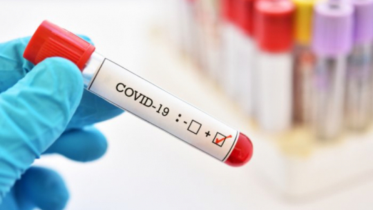 4,343 people recover from Coronavirus in Far-West