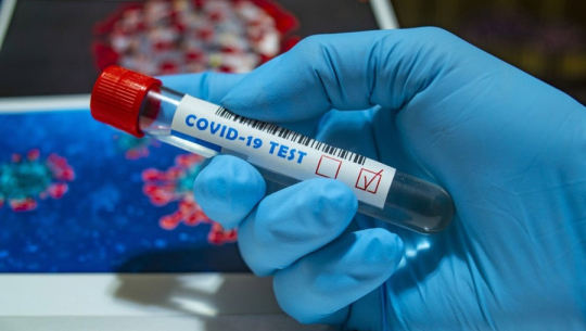 थप १६ जनामा कोरोना संक्रमण पुष्टि