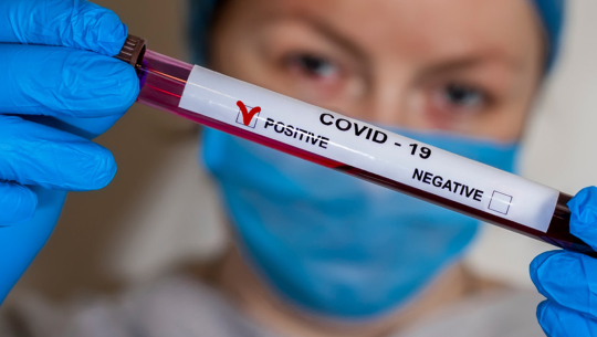 थप १६ जनामा कोरोना संक्रमण पुष्टि