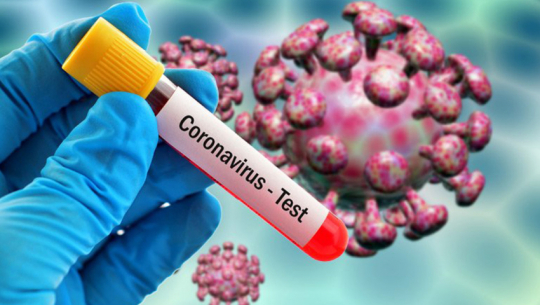 कञ्चनपुरको गड्डाचौकी नाकामा पनि तीन जनामा देखियो कोरोना