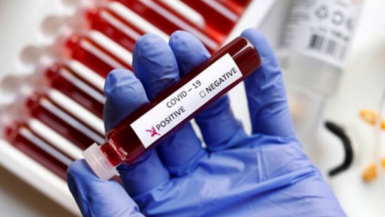 देशभर थप ४३ जनामा कोरोना संक्रमण पुष्टि 