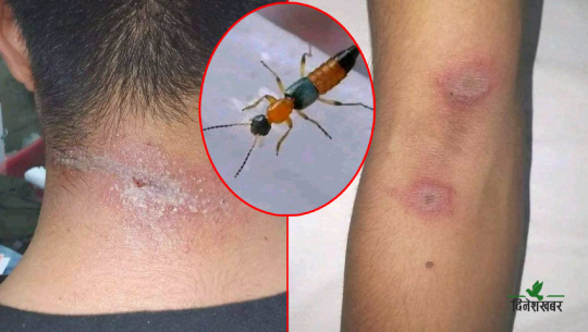 कैलाली–कञ्चनपुरमा ‘नाइरोबी फ्लाइ’को आतंक