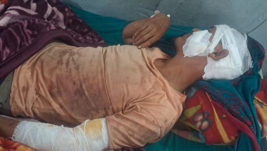 अछाममा बाघको आक्रमणबाट एक जना घाइते