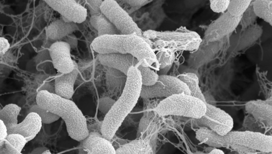 कैलालीमा एक महिलामा देखियो हैजा