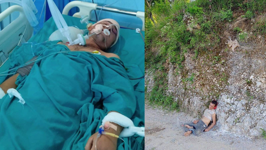 धनगढीको अस्पतालमा बैतडीका कलौनी ५ दिनदेखि अचेत, भिरबाट लडेर कि हत्या प्रयास ?