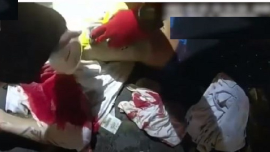 चक्कु प्रहारबाट गम्भीर घाइतेको ज्यान आलुचिप्सको खोलले जोगाएपछि...