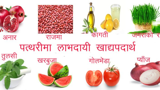 मिर्गौलाको पत्थरीबाट छुट्कारा पाउने घरेलु उपाय
