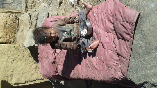अभिभावकको वेवास्ताका कारण बालबालिका कुपोषित