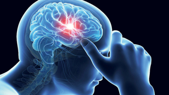 माइग्रेनबाट राहत पाउने घरेलु उपाय