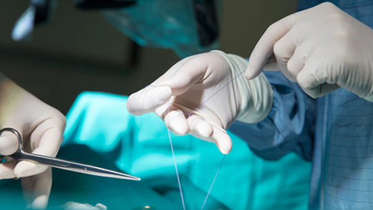 अलग्गिएको यौनाङ्ग जोडेर डाक्टरले रेकर्ड बनाएपछि...