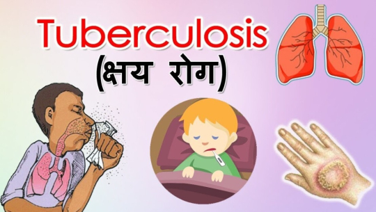 लालझाडीमा ७४८ जनाको निःशुल्क क्षयरोग परीक्षण